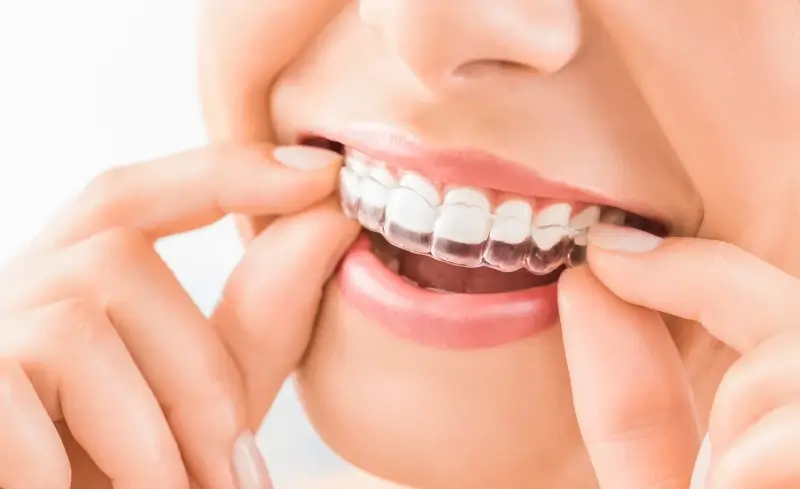 Czy leczenie Invisalign boli?