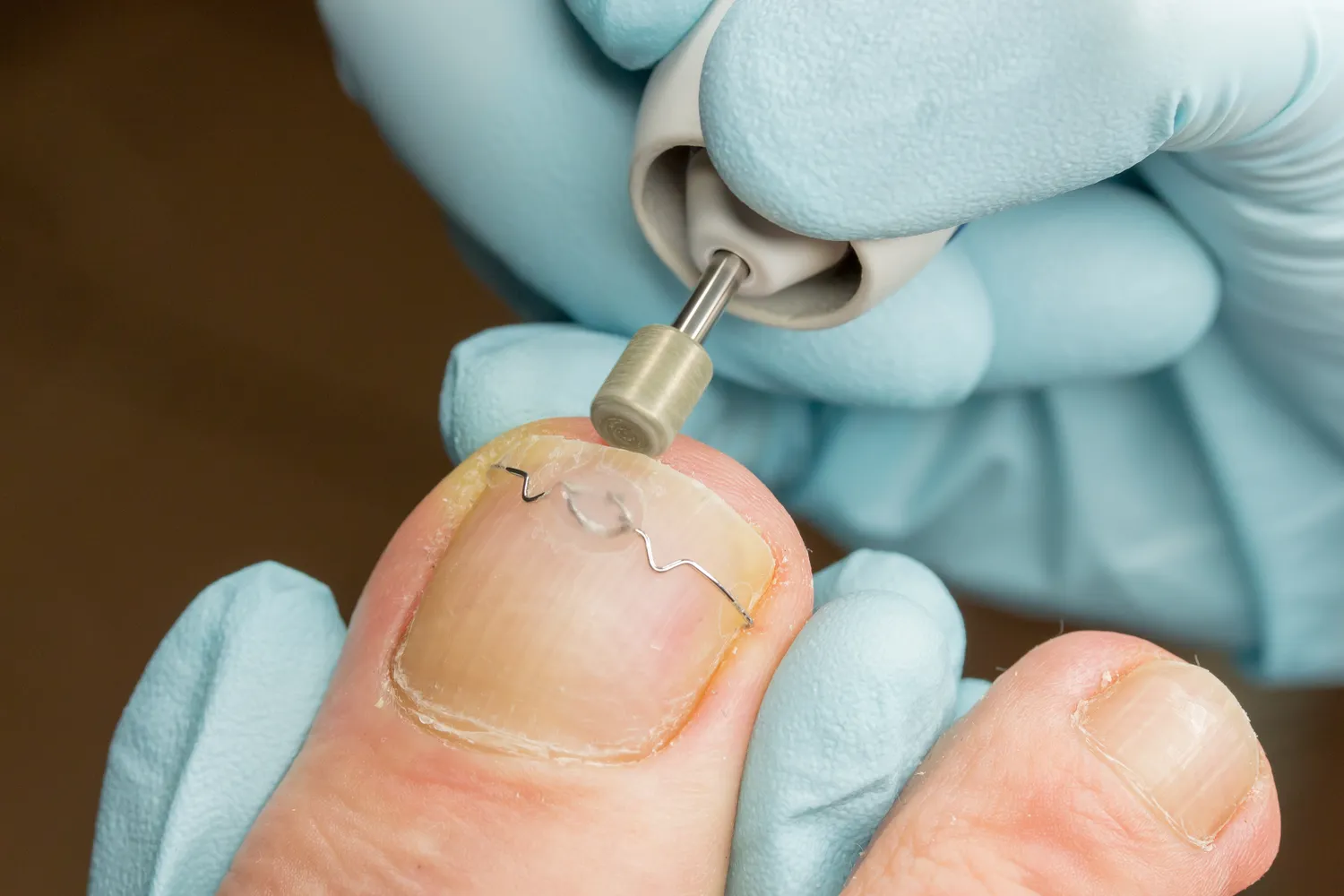 Czym zajmuje się podologia?