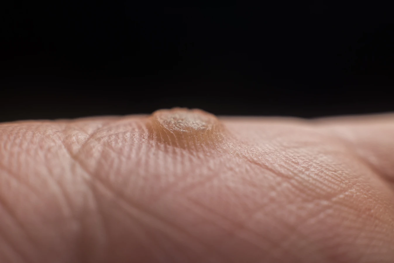  Pedicure leczniczy - czym jest i na jakie efekty możesz liczyć?